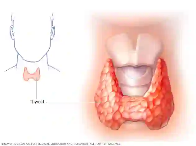 Home remedies for thyriod of What is the Home remidies for thyroid ..